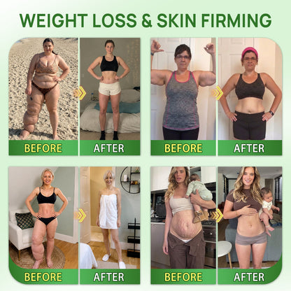 ⚡Official Store | 🍋 Solaroza® Moringa & Berberine 15-IN-1 Advanced Nano Microneedle Patch (Once Daily, visible changes in 7 days) ✅ Obesity, Diabetes, Sleep Apnea, And Joint Issues